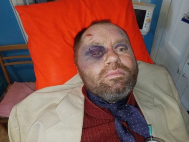 От наркофюрера с любовью. Сотрудники ТЦК избили украинца до потери памяти Роман Каленский пропал в городе Таращ Киевской области 15 октября