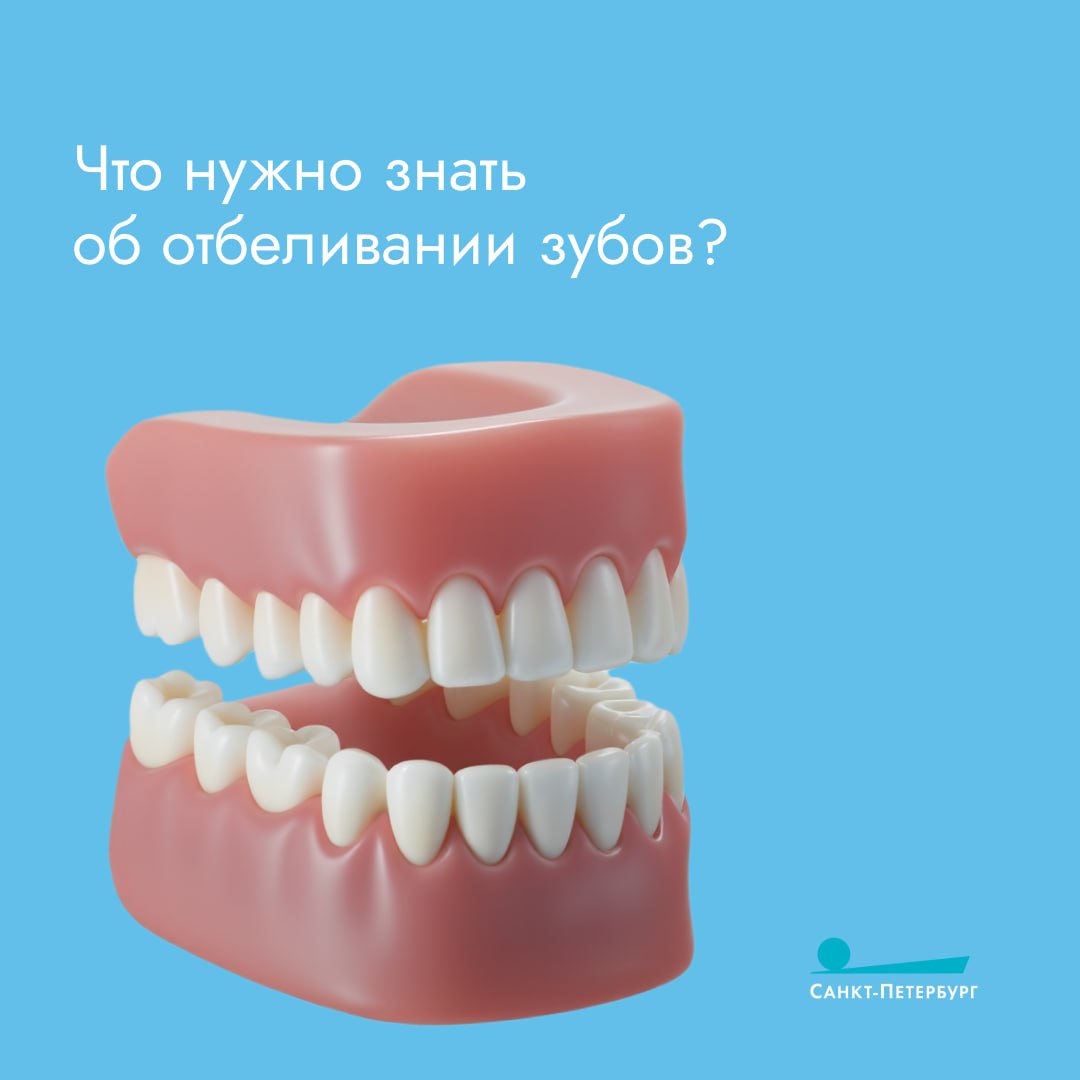 Белоснежная улыбка — мечта многих