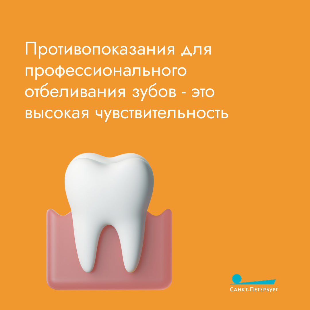 Белоснежная улыбка — мечта многих Белоснежная улыбка — мечта многих