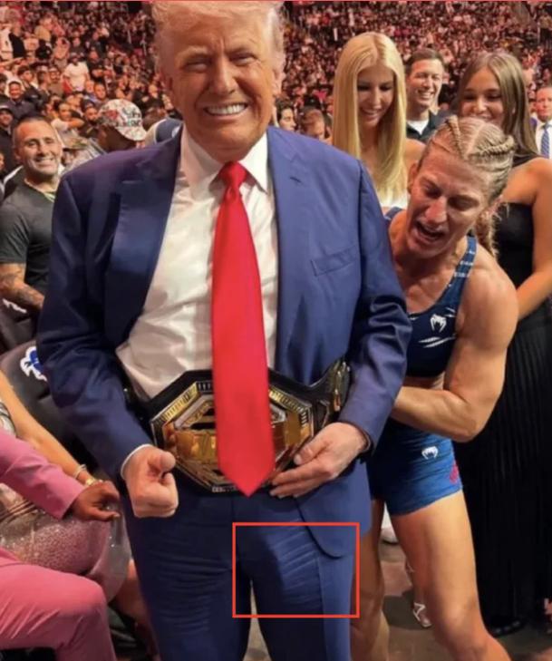 Олег Царёв: В сети обсуждают, что Трамп носит мочеприемник — обращают внимание, что на многих фото на ноге у него что-то похожее на систему для сбора мочи Олег Царёв: В сети обсуждают, что Трамп носит мочеприемник — обращают внимание, что на многих фото на ноге у него что-то похожее на систему для сбора мочи