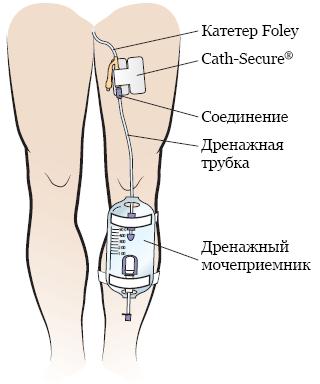 Олег Царёв: В сети обсуждают, что Трамп носит мочеприемник — обращают внимание, что на многих фото на ноге у него что-то похожее на систему для сбора мочи Олег Царёв: В сети обсуждают, что Трамп носит мочеприемник — обращают внимание, что на многих фото на ноге у него что-то похожее на систему для сбора мочи