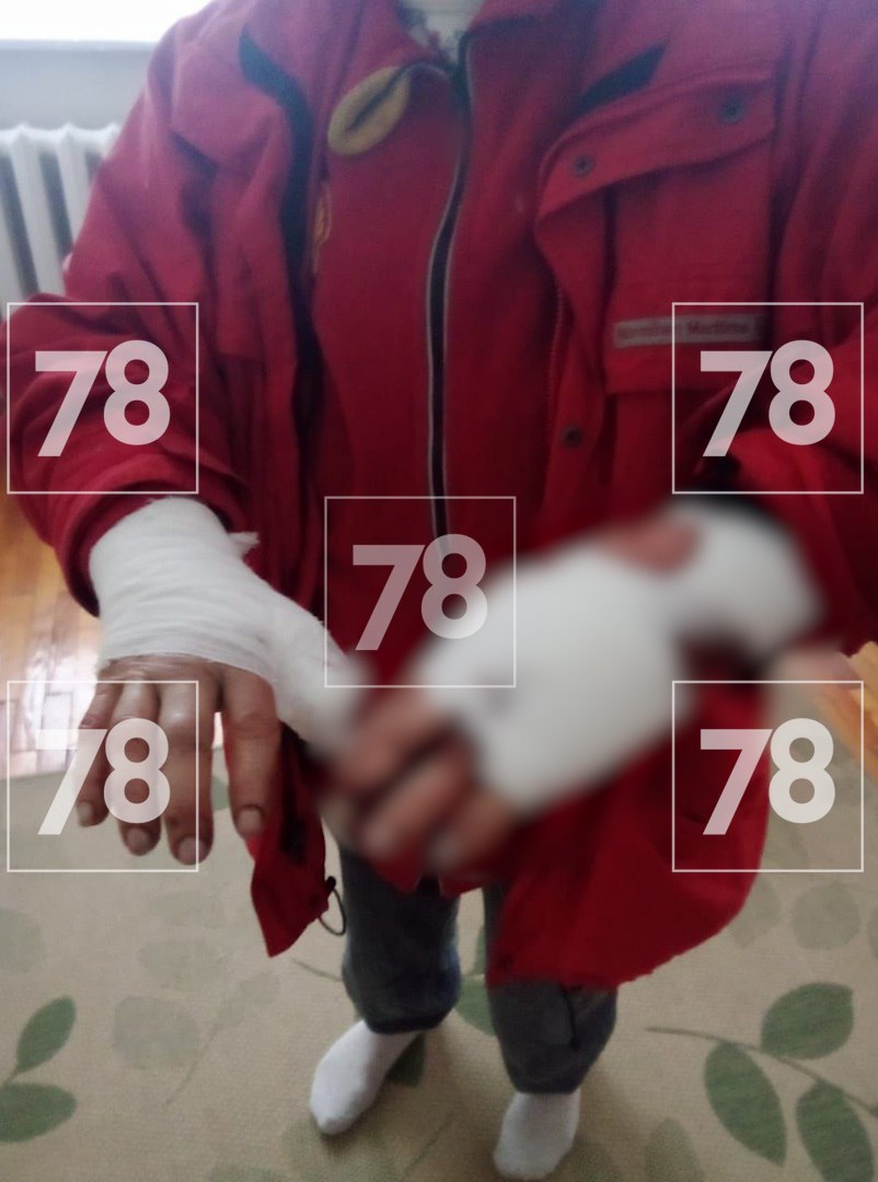 Две большие собаки напали на женщину с таксой в Новом Токсово Две большие собаки напали на женщину с таксой в Новом Токсово