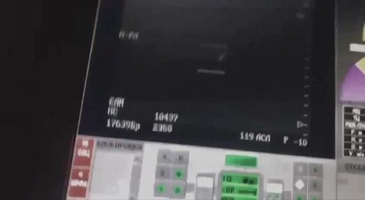  :    &quot;&quot;   &quot;&quot;