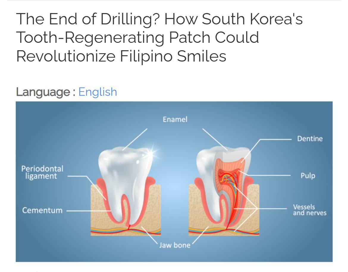 Олег Царёв: Скоро у взрослых смогут вырастать свои новые зубы — южнокорейские учёные из Сеульского национального университета разработали микроигольчатый пластырь, который стимулирует стволовые клетки в дёснах для...