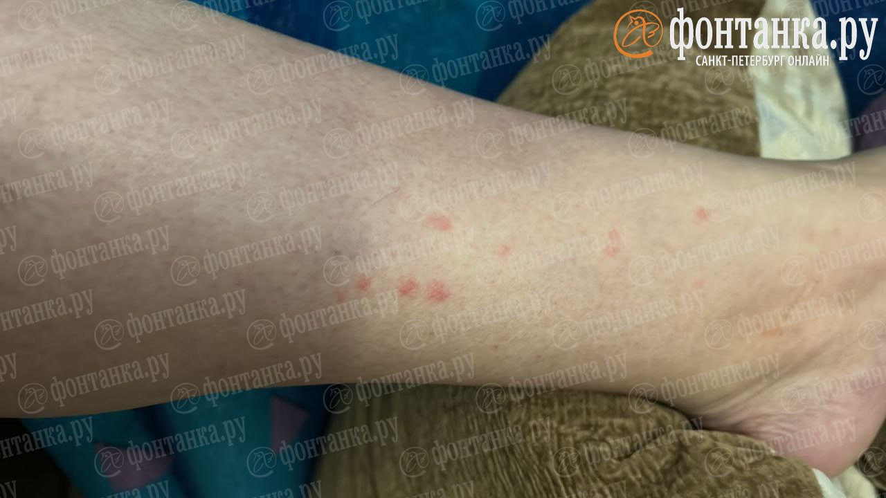 «Несколько ночей невозможно спать» «Несколько ночей невозможно спать»