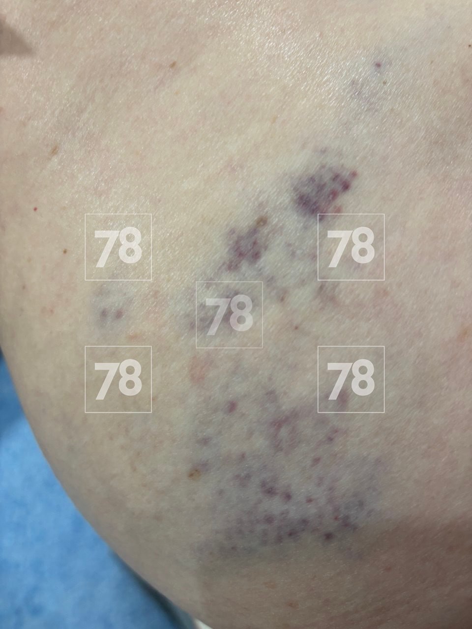 «Поехал не по своей траектории, неадекватное вождение»: пострадавшая петербурженка рассказала о ЧП с аэролодкой в Карелии «Поехал не по своей траектории, неадекватное вождение»: пострадавшая петербурженка рассказала о ЧП с аэролодкой в Карелии