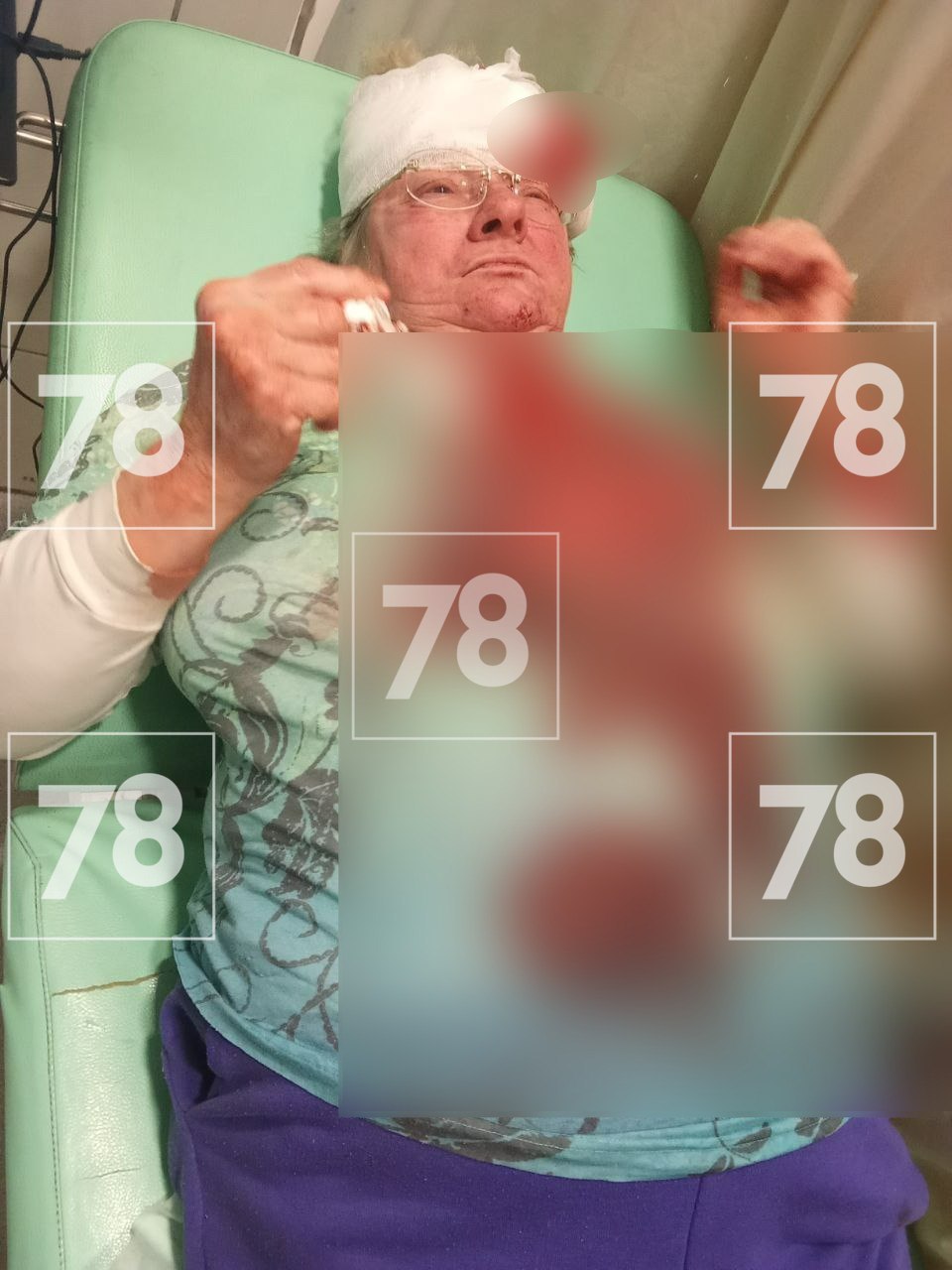 После избиения женщины во дворе дома на Невском полиция задержала 51-летнего мужчину