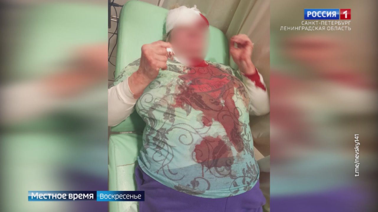 В Петербурге мужчина избил пенсионерку из-за замечаний о выгуле собак