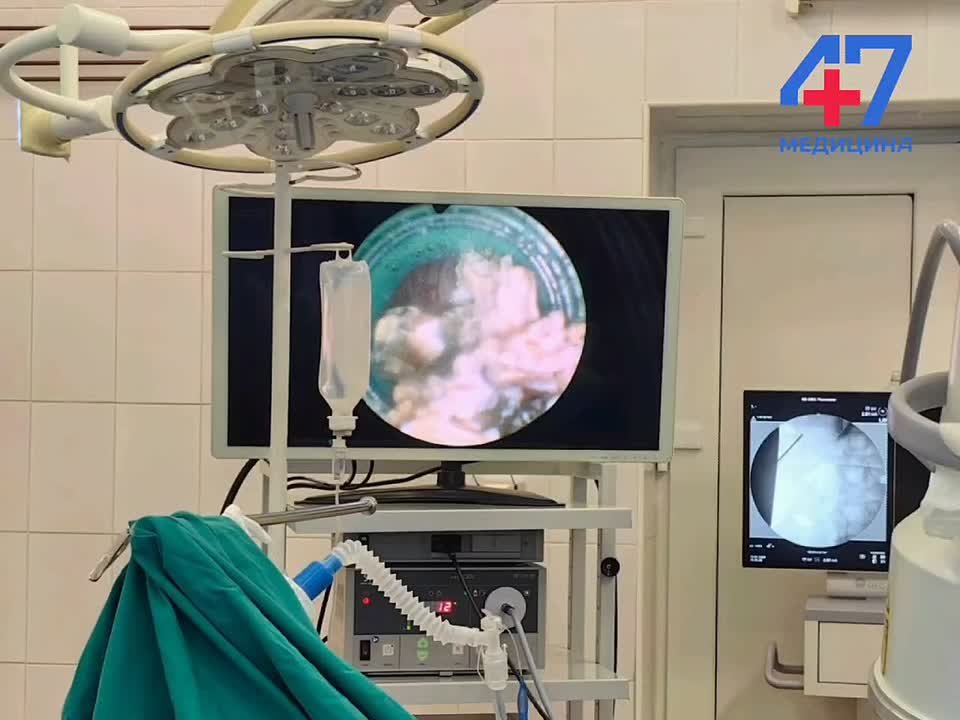 Пожилому пациенту Всеволожской больнице удалили камни из почек с помощью новой методики