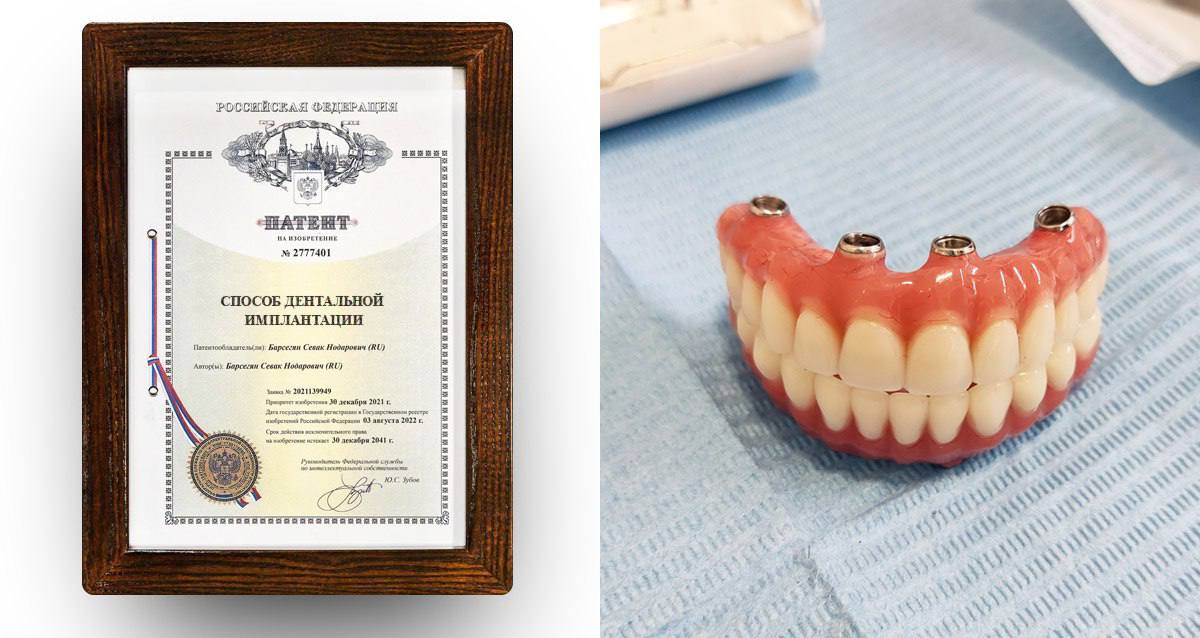 Два майора: История из жизни.. Боец на СВО приехал в отпуск и за 3 дня полностью восстановил зубы Два майора: История из жизни.. Боец на СВО приехал в отпуск и за 3 дня полностью восстановил зубы