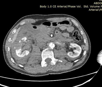 ����� ��� ���������� ������ �������� � �������� ����� ����� ������� ������