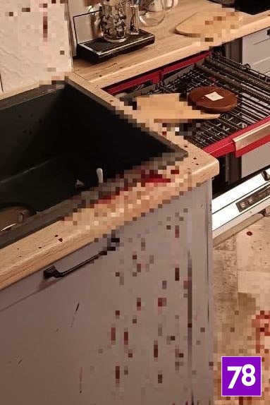 Мужчина раскритиковал свежий ремонт сожительницы за что получил от нее удар ножом Мужчина раскритиковал свежий ремонт сожительницы за что получил от нее удар ножом