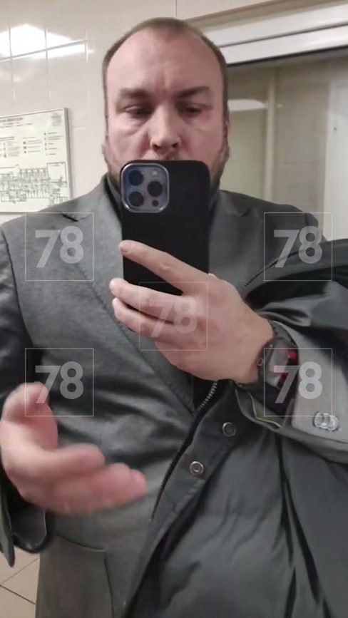 Глава администрации Кузьмолово Кобзев поругался в больнице с медсестрой и пнул ее