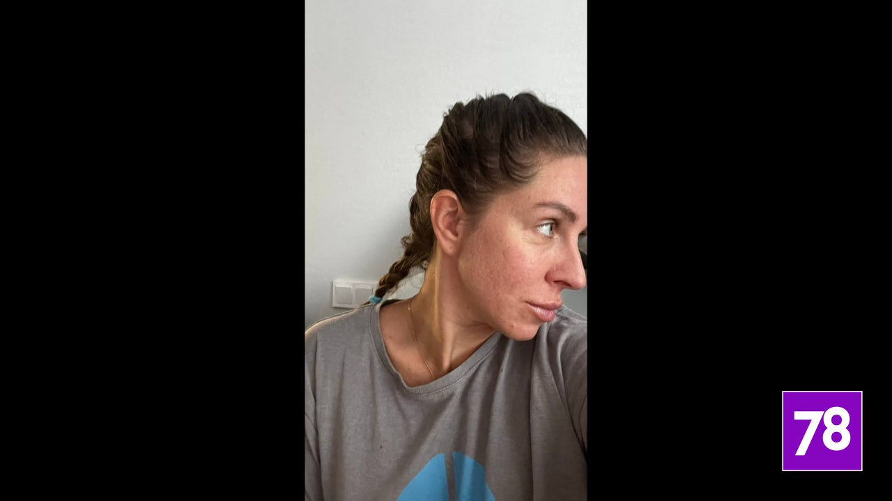 «Кожа была как тряпка в месте вкола»: петербурженка пострадала после посещения косметолога «Кожа была как тряпка в месте вкола»: петербурженка пострадала после посещения косметолога