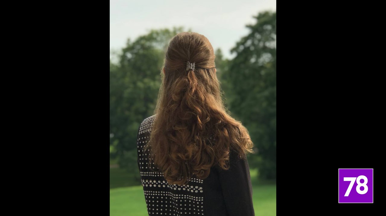 «Кожа была как тряпка в месте вкола»: петербурженка пострадала после посещения косметолога «Кожа была как тряпка в месте вкола»: петербурженка пострадала после посещения косметолога