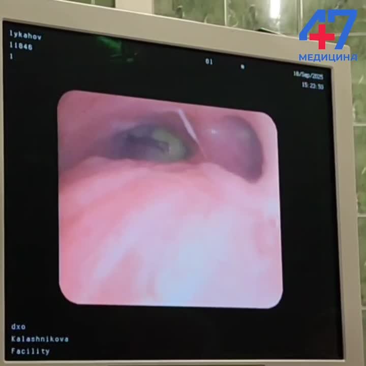 В ЛОДКБ спасли двух мальчиков, вдохнувших канцелярские кнопки