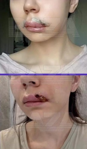 ���������� ������ ������ ��������� ���� � ������� ��������, �� ��������� �� ������������ ����� ��-�� ���������� ������ ����� ��������