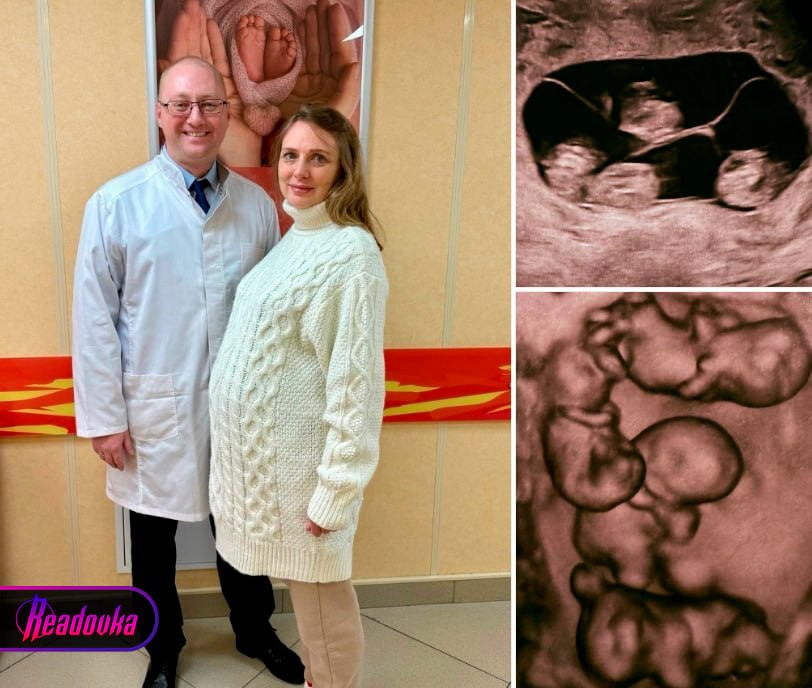 Один случай на 15,5 млн родов — петербурженка родила однояйцевых четверняшек