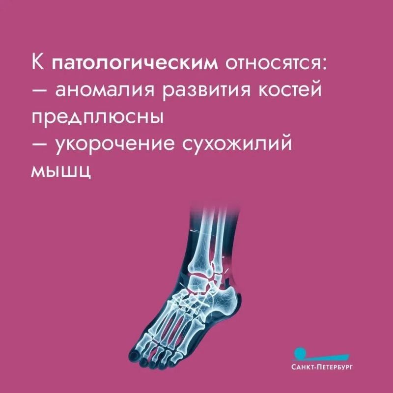 Плоскостопие встречается у многих детей и связано с особенностями развития стоп в раннем возрасте Плоскостопие встречается у многих детей и связано с особенностями развития стоп в раннем возрасте
