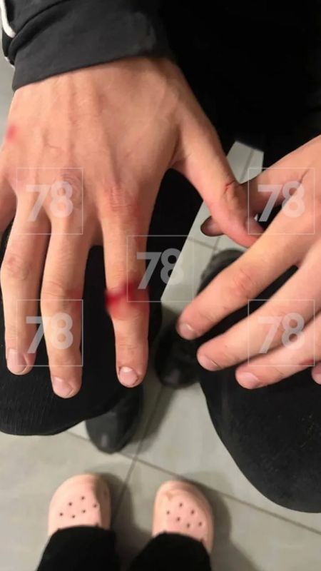 Жителя Мурино жестоко избили хулиганы из-за замечаний Жителя Мурино жестоко избили хулиганы из-за замечаний