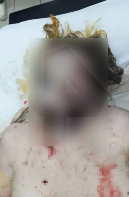 ОСТОРОЖНО, ЖЕСТКИЕ КАДРЫ. 18+
