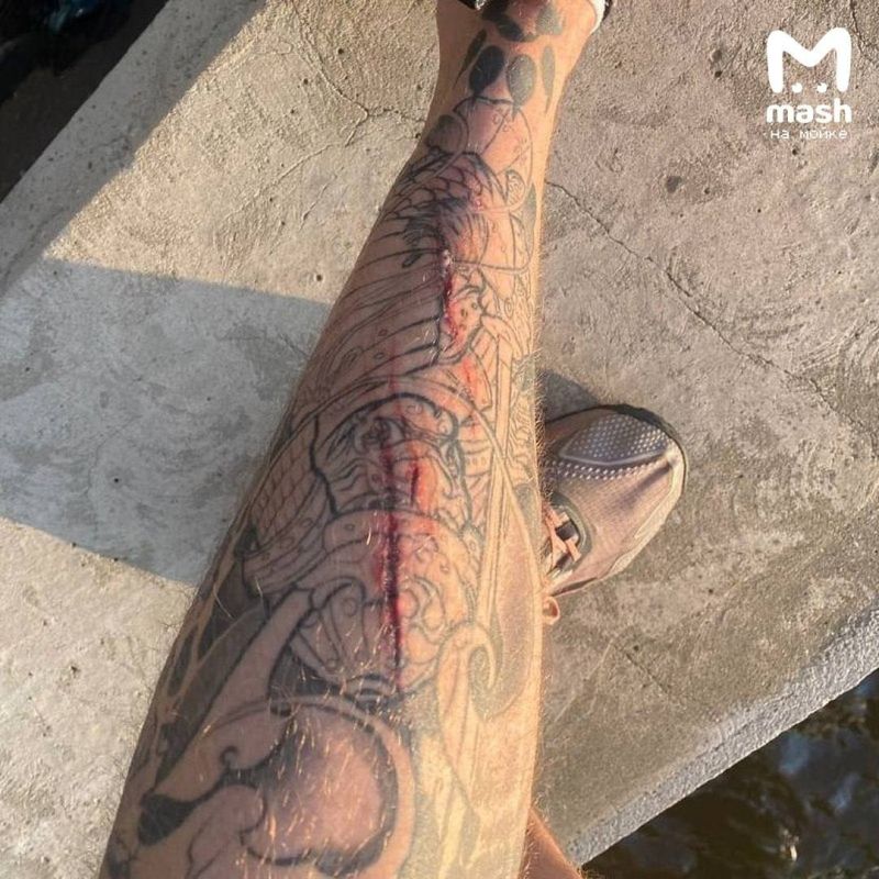 Медведь напал на велосипедиста около КАДа в Янино — последствия встречи на фото