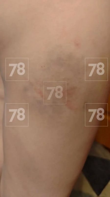 Четверых первоклашек избили ремнём за то, что они пробрались на чужой участок Четверых первоклашек избили ремнём за то, что они пробрались на чужой участок