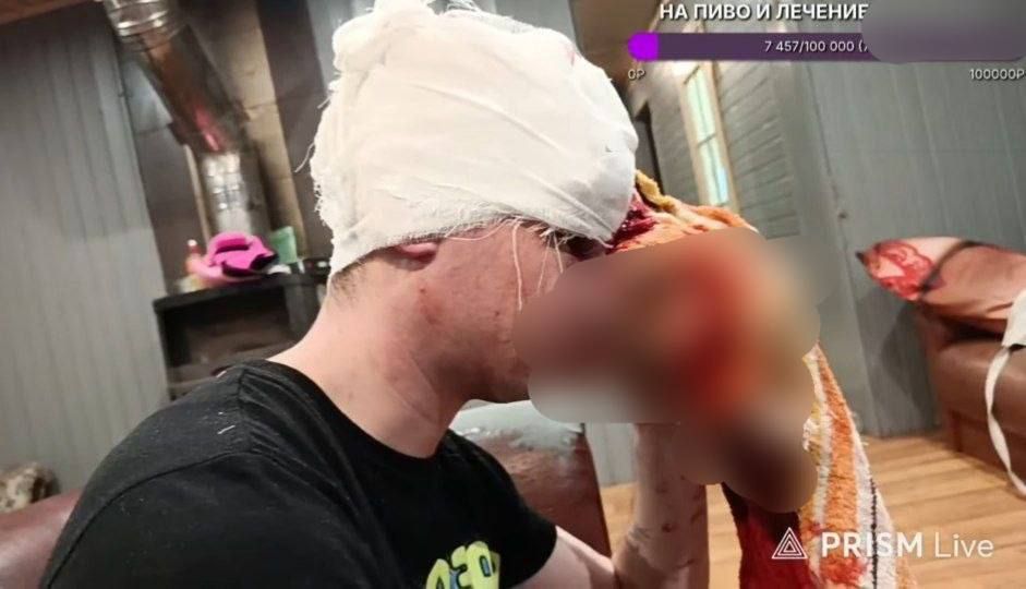 Треш-стримеры из Петербурга устроили поножовщину в прямом эфире, сообщила Екатерина Мизулина Треш-стримеры из Петербурга устроили поножовщину в прямом эфире, сообщила Екатерина Мизулина