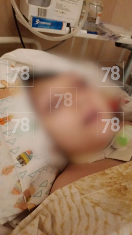 «Она вроде бы здесь, но не совсем»: 12-летняя Варя ждёт операцию после ДТП в Пушкине «Она вроде бы здесь, но не совсем»: 12-летняя Варя ждёт операцию после ДТП в Пушкине