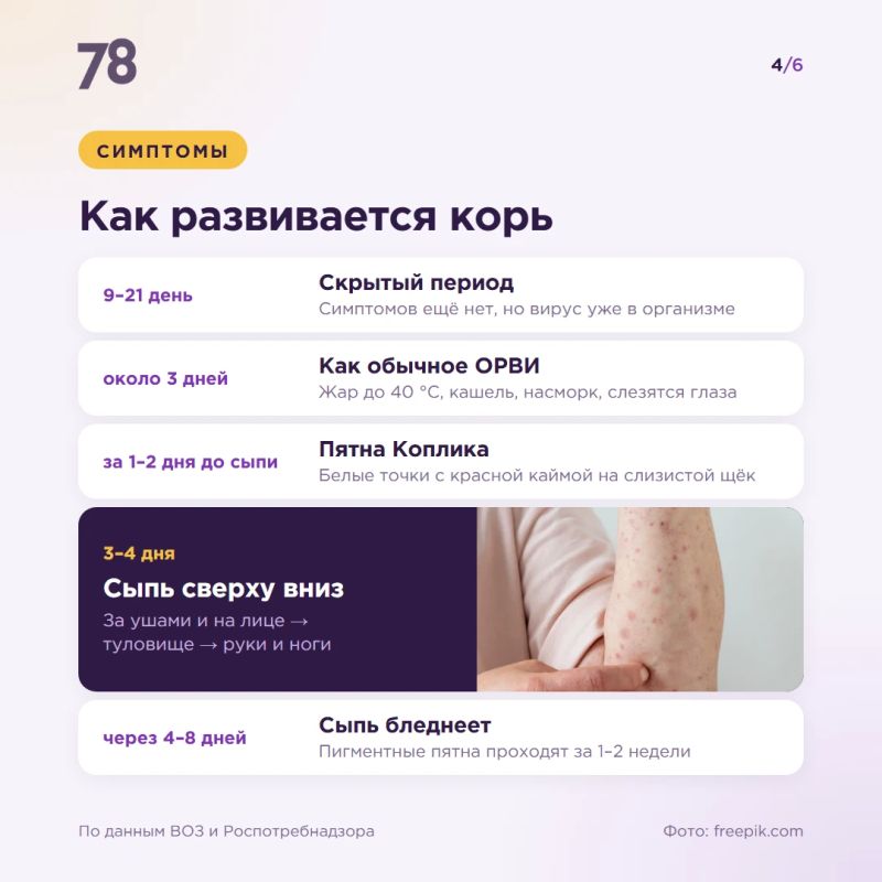 Согласно данным ВОЗ, в 2024 году в мире корью заболели 11 млн человек, из них умерли около 95 тыс., в основном — дети до 5 лет Согласно данным ВОЗ, в 2024 году в мире корью заболели 11 млн человек, из них умерли около 95 тыс., в основном — дети до 5 лет